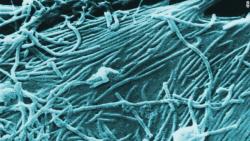 Focar de Ebola în vestul Ugandei